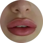 شفاه